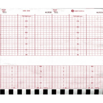 CMS 4305 Chart Paper 152mm X 47'